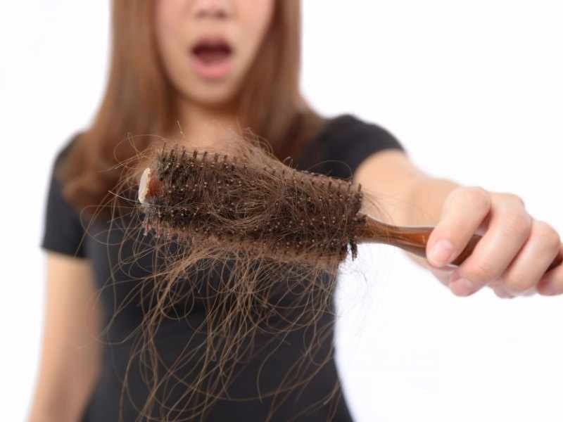 Caída de cabello en mujeres Minoxidil Costa Rica